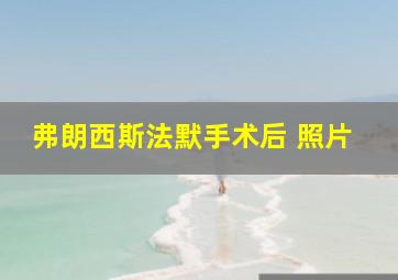 弗朗西斯法默手术后 照片